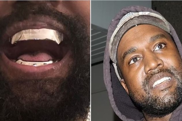 Ο Kanye West αφαίρεσε όλα τα δόντια του και τα αντικατέστησε με οδοντοστοιχία από τιτάνιο! Λαμπυρίζουν το βράδυ μπρρρρρρ (βίντεο) - Κυρίως Φωτογραφία - Gallery - Video