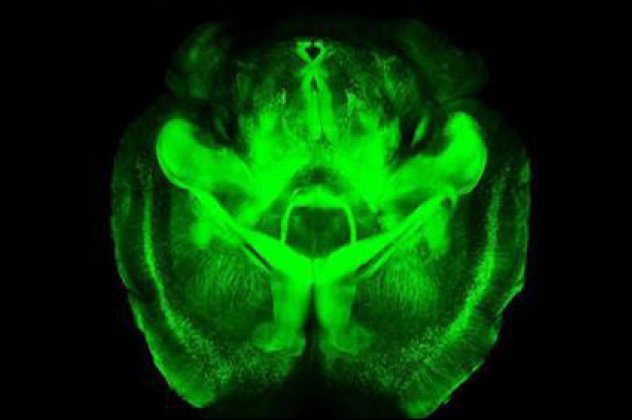 «Διάφανο» εγκέφαλο έφτιαξαν επιστήμονες στο Πανεπιστήμιο του Στάνφορτ! (βίντεο και φώτο) - Κυρίως Φωτογραφία - Gallery - Video