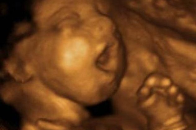 Δείτε το χασμουρητό και τον λόξυγγα των εμβρύων σε 4D, τέσσερις διαστάσεις για το μωρό των ονείρων σας! - Κυρίως Φωτογραφία - Gallery - Video