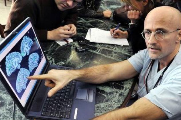 «Δυνατή η μεταμόσχευση κεφαλής σε δύο χρόνια», δηλώνει Ιταλός νευροχειρουργός‏ - Κυρίως Φωτογραφία - Gallery - Video