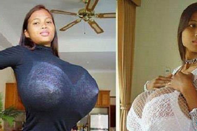 Υποφέρει η 16χρονη με το μεγαλύτερο στήθος στον κόσμο: 26 ολόκληρα κιλά (φωτό) - Κυρίως Φωτογραφία - Gallery - Video