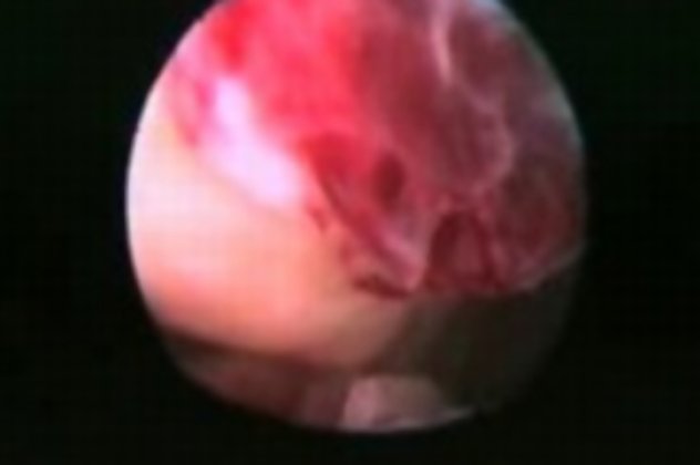Δείτε για πρώτη φορά την ανθρώπινη ωορρηξία σε βίντεο! - Κυρίως Φωτογραφία - Gallery - Video