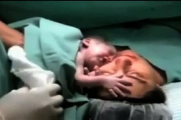 Συγκινητικό -  Νεογέννητο αρνείται να αποχωριστεί τη μαμά του μετά τον τοκετό! (βίντεο)  - Κυρίως Φωτογραφία - Gallery - Video