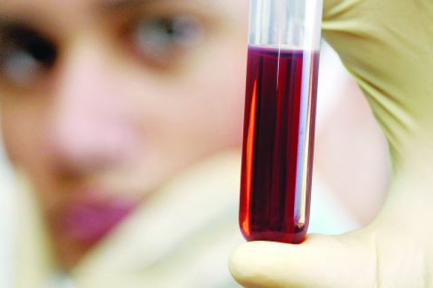 Επιστήμονες δημιούργησαν τεχνητό αίμα με αιμοσφαίρια από βλαστοκύτταρα-Θα μπορεί να δοκιμαστεί σε ανθρώπους το 2016 - Κυρίως Φωτογραφία - Gallery - Video