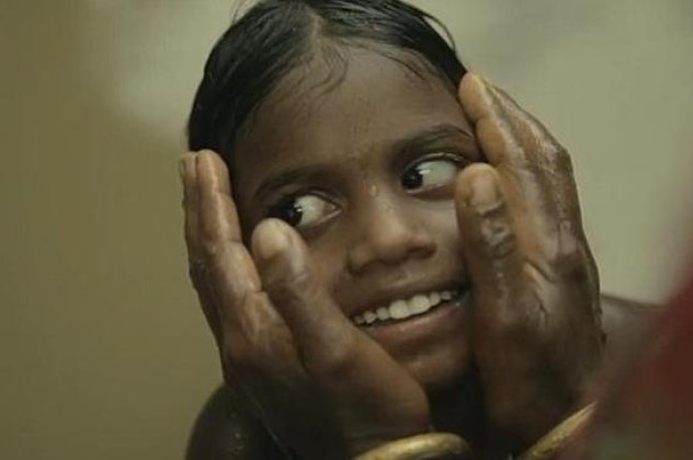 Story of the day : «Μαμά σε βλέπω»- Η συγκινητική ιστορία δυο κοριτσιών στην Ινδία που ήταν τυφλές γιατί δεν υπήρχαν 300 δολάρια για την εγχείριση τους (φωτό & βίντεο) - Κυρίως Φωτογραφία - Gallery - Video