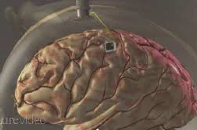 23χρονος τετραπληγικός κουνά και πάλι το χέρι του χάριν σε εμφυτευμένο τσιπ στον εγκέφαλο του: Δείτε το βίντεο  - Κυρίως Φωτογραφία - Gallery - Video