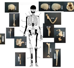 Πέντε οι σκελετοί που βρέθηκαν στον τάφο της Αμφίπολης - Μία γυναίκα, δύο νέοι, ένα μωρό και ένας καμμένος άντρας - 550 θρυμματισμένα οστά & αλόγου στον Τύμβο!
