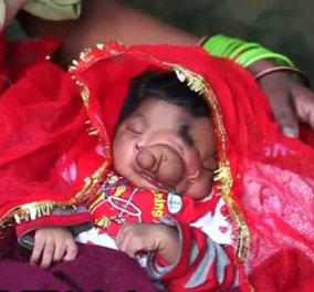 Απίστευτο: Κοσμοσυρροή στην Ινδία για το μωρό που γεννήθηκε με προβοσκίδα - λατρεύεται σαν θεός