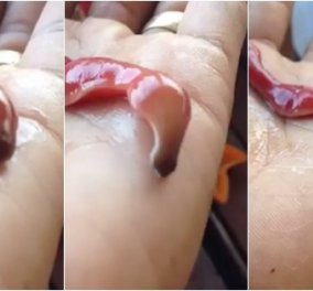 Βίντεο: Τον τσίμπησε αυτό το τρομακτικό σκουλήκι & του "κέντησε" με δηλητήριο το χέρι