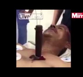 Βίντεο - Πολύ σκληρές εικόνες: Μαχαίρι σφηνωμένο στην καρδιά του πάλλεται στο ρυθμό των χτύπων της!  