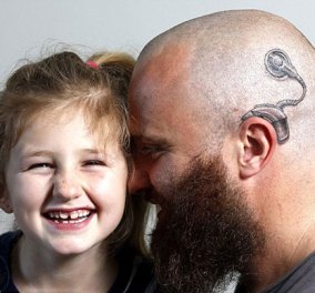 Story: Πατέρας έκανε τατουάζ το εμφύτευμα της κωφής κόρης του στο αυτί για να τη στηρίξει  