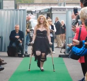 Top Woman η 20χρονη Βίκι Μπαλτς - Έχασε το πόδι της σε συντριβή rollercoaster & περπάτησε στην πασαρέλα για φιλανθρωπικό σκοπό