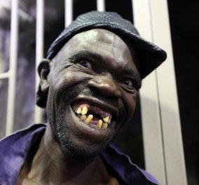 Ζιμπάμπουε: Σκάνδαλο στα καλλιστεία για τον «Mister Ugly» - Ο νικητής δεν είναι πολύ... άσχημος!