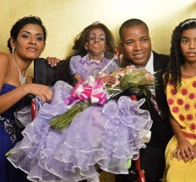 Στο αναπηρικό καροτσάκι γιόρτασε τα γενέθλια 15χρονη πρόωρα γερασμένη κοπέλα - Την έκαναν πριγκίπισσα για μια μέρα