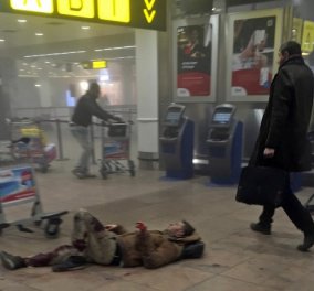 Συγκλονιστική φωτό από τις Βρυξέλλες: Βίδα καρφωμένη στο κορμί τραυματία του μακελειού 