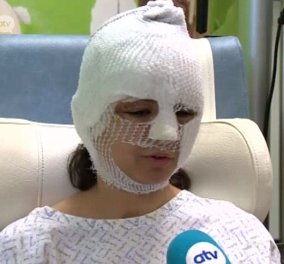 20χρονη τραυματίας των Βρυξελλών με εγκαύματα: Ήρθε το τέλος του κόσμου είπα… 