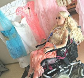 H συγκινητική ιστορία της 26χρονης τετραπληγικής Τζάσμιν: Ξόδεψε πάνω από 12.000 ευρώ για να γίνει σαν τη Barbie 