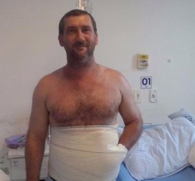 Οι γιατροί του έραψαν το τραυματισμένο χέρι μέσα στην κοιλιά του για να το σώσουν - Φώτο, βίντεο 