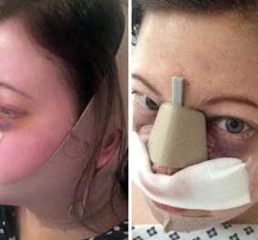 Story: Η 28χρονη Shelley έκανε πλαστικές 16.00 λιρών στο πρόσωπο για να φαίνεται πιο όμορφη στις φωτογραφίες - Δείτε πώς έγινε