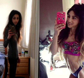 Τop Woman η νεαρή Αρόσα - Νίκησε την ανορεξία και σήμερα είναι "star" του instagram