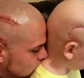 Πολύ συγκινητικό: Ο μπαμπάς κάνει τατουάζ στο κεφάλι για να μοιάζει με του καρκινοπαθούς γιου του   