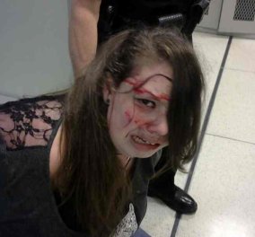 Πρωτοφανές & ντροπή: Χτύπησαν & συνέλαβαν 18χρονη, ανάπηρη καρκινοπαθή στον έλεγχο αεροδρομίου  