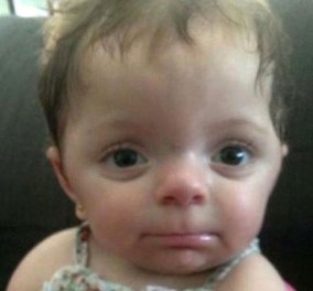 Το πιο μικροσκοπικό 4χρονο κοριτσάκι στον κόσμο είναι Ελληνικής καταγωγής: "Μοιάζει με κουκλίτσα λόγω ασθένειας" 