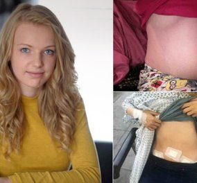 16χρονη έδειχνε έγκυος 6 μηνών, ντρεπόταν & κρυβόταν αλλά τελικά άλλο είχε στη κοιλιά της
