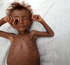 Γι'αυτά τα παιδιά που πεθαίνουν από την πείνα στην Υεμένη (φωτό) υπάρχει έλεος ;