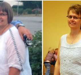 Story of the day: H 43χρονη Carola έχασε 60 κιλά αδειάζοντας με «βρύση» το στομάχι της μετά από κάθε γεύμα