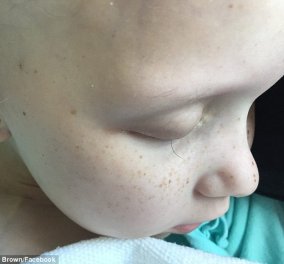 Αυτό το 7χρονο αγγελούδι με καρκίνο πληγώνει τον πλανήτη: Η τελευταία της βλεφαρίδα πέφτει από την σκληρή χημειοθεραπεία