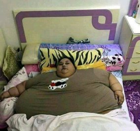 Η 36χρονη που ζυγίζει 500 κιλά βγαίνει από το σπίτι της μετά από 25 χρόνια: Θα χειρουργηθεί για να χάσει 400
