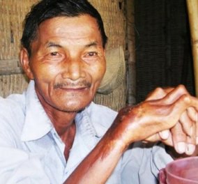 Story of the day : Βιετναμέζος έχει αυπνία από το 1973 - 44 χρόνια παραμένει άυπνος και δουλεύει νύχτα-μέρα