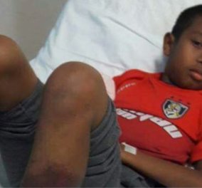 11χρονο αγόρι μαστιγώθηκε από τον δάσκαλό του μέχρι θανάτου -Ακρωτηρίασαν τα πόδια του & τελικά υπέκυψε 