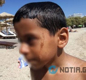 'Αλιμος: Μικρά παιδιά έκαναν μπάνιο και βγαίνουν με πίσσες (ΦΩΤΟ)