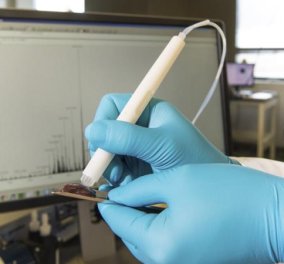 Αυτό το στυλό είναι το νέο νυστέρι: Χειρουργεί 150 φορές πιο γρήγορα τον καρκίνο 