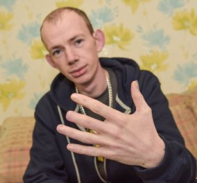 Φώτο: 26χρονος έγινε τύφλα στο μεθύσι: Ξύπνησε και είχε μισό δάχτυλο και αμνησία 
