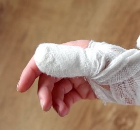Δεν το χωρά ανθρώπινος νους: Γυναίκα έκοψε το χέρι της για να λάβει ιατρική αποζημίωση ύψους 400.000 ευρώ