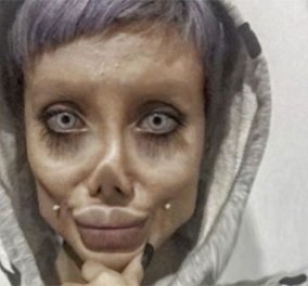 22χρονη έκανε άπειρες πλαστικές για να μοιάσει στην Αντζελίνα Τζολί -  Κατέληξε ζόμπι & συνελήφθη για βλασφημία στο Ιράν (φωτό)