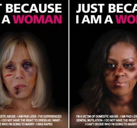 Μπριζίτ Μακρόν & Μισέλ Ομπάμα: Με πρησμένα & γεμάτα μώλωπες πρόσωπα - Συγκλονιστικό μήνυμα κατά της βίας των γυναικών 