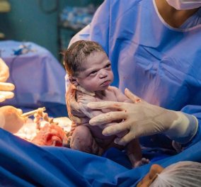 Απίστευτη εικόνα! Το νεογέννητο μωρό ρίχνει σκληρή ματιά στον γυναικολόγο, μόλις βγαίνει από την κοιλιά της μαμάς του - viral 