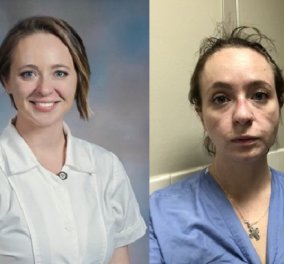 Πριν & μετά: Συγκινεί η εικόνα μιας 27χρονης νοσοκόμας έπειτα από 8 μήνες στη "μάχη" με τον κορωνοϊό- Κουρασμένη, γερασμένη, ταλαιπωρημένη (φωτό- βίντεο)