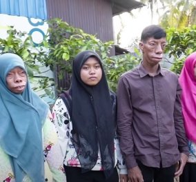 Story of the day: Τα μέλη οικογένειας στην Ινδονησία μετατρέπονται σε «τέρατα» - το γενετικό πρόβλημα ξεκινάει από τον πατέρα (βίντεο)