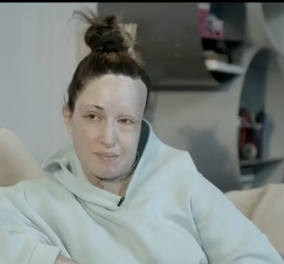 Ιωάννα Παλιοσπύρου: Έβγαλε την μάσκα και συγκλόνισε - ''Αυτό είναι το σημείο 0, η ζωή μου υπάρχει πριν & μετά την επίθεση'' (βίντεο) 
