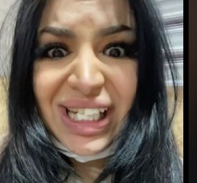 26χρονη πήγε να φτιάξει τα δόντια της & κατέληξε να μοιάζει με άλογο! Ο οδοντίατρος αποδείχτηκε… φοιτητής (βίντεο)