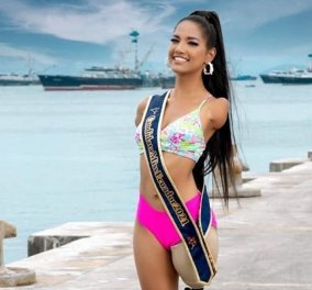 Topwoman η Victoria Salcedo: Της ακρωτηρίασαν τα άκρα όταν ήταν 6 ετών - Τώρα είναι μοντέλο με δεκάδες χιλιάδες followers (φωτό & βίντεο)