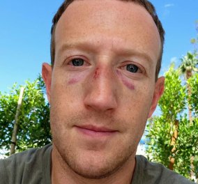 O Mark Zuckerberg ποζάρει με δύο μαυρισμένα μάτια - Με ποιον πιάστηκε στα χέρια; (φωτό)