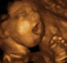 Δείτε το χασμουρητό και τον λόξυγγα των εμβρύων σε 4D, τέσσερις διαστάσεις για το μωρό των ονείρων σας! - Κυρίως Φωτογραφία - Gallery - Video