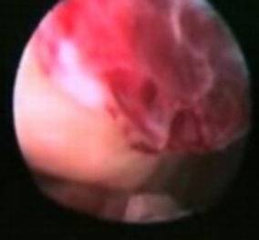 Δείτε για πρώτη φορά την ανθρώπινη ωορρηξία σε βίντεο! - Κυρίως Φωτογραφία - Gallery - Video