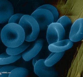 Πάνω από 7.000 άνθρωποι στον κόσμο έχουν μπλε αίμα και δεν κινδυνεύουν από αιμοραγία! - Κυρίως Φωτογραφία - Gallery - Video